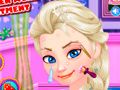 Spel Acnebehandeling van de IJs Koningin online