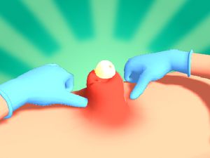 Spel Puistje knijpen online
